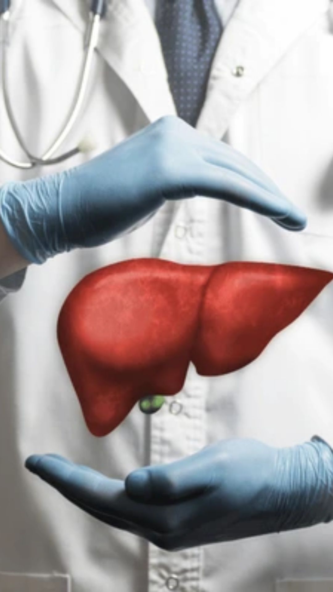liver disease