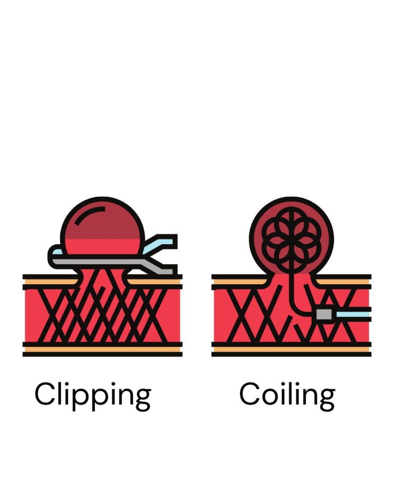 clipping and coiling