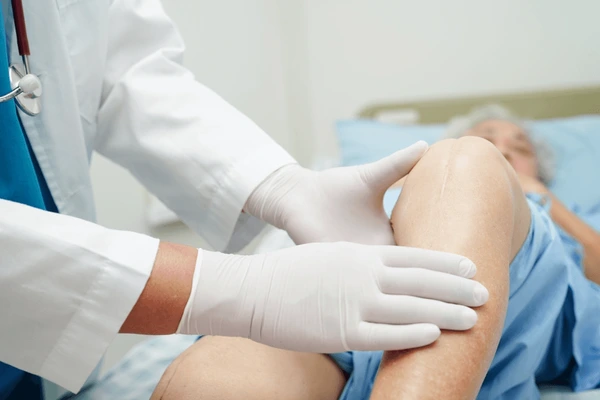 treatment for knee osteoarthritis