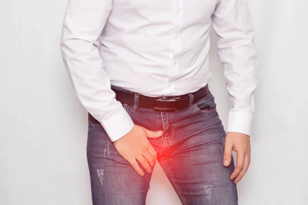 varicocele treatment