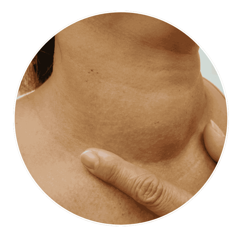 neck swelling or lump
