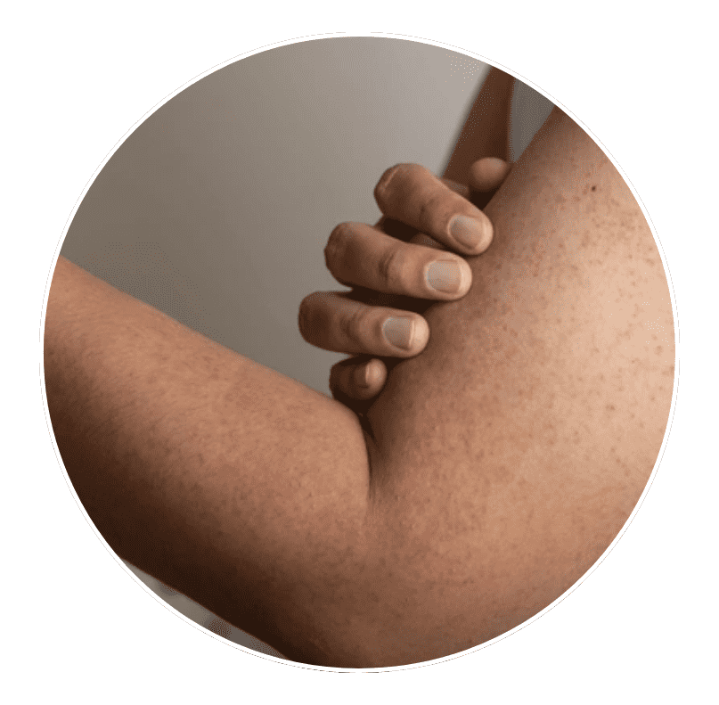 cold or pale hand