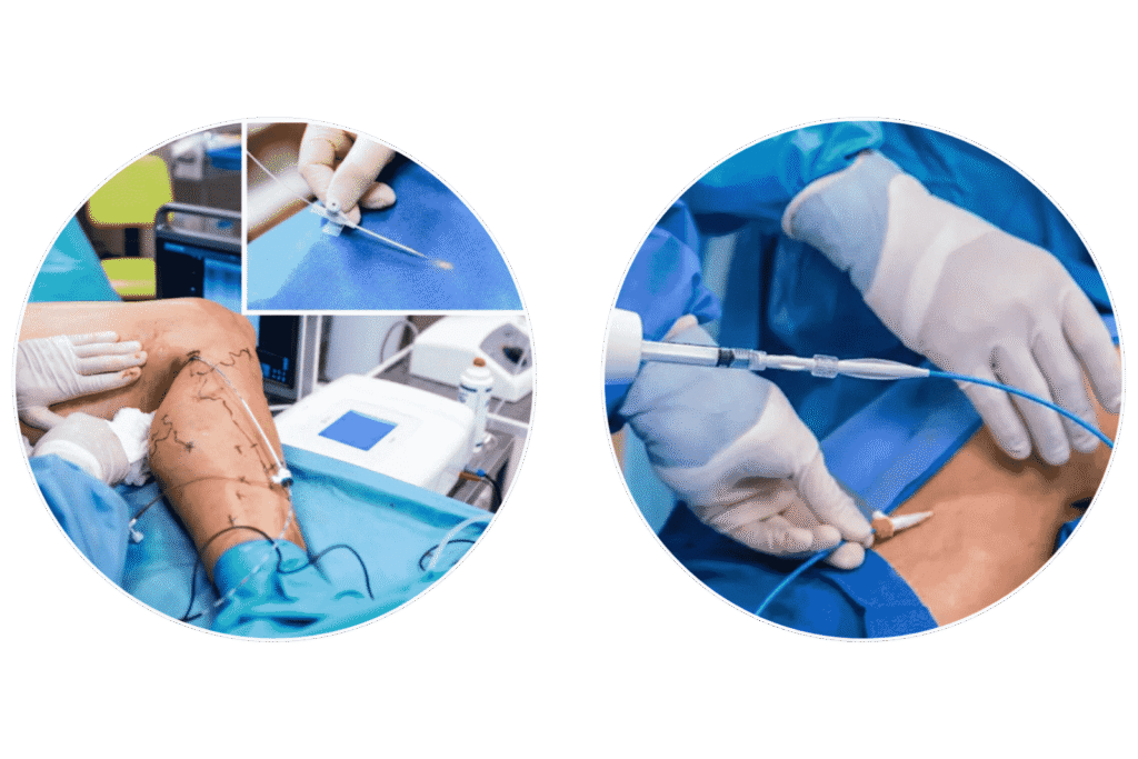 varicose veins specialist