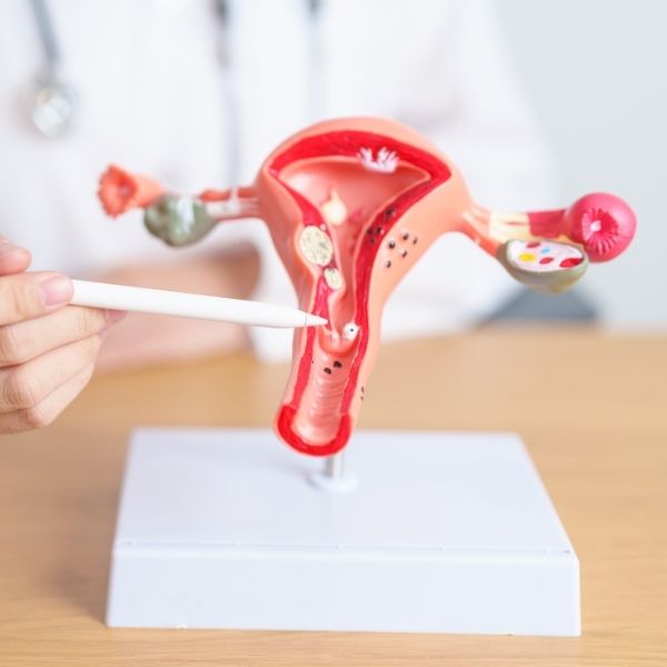 What Are Uterine Fibroids?