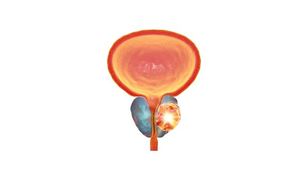 What is Prostate Gland?