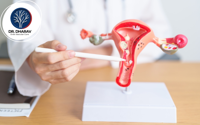 uterine fibroids treatment in mumbai