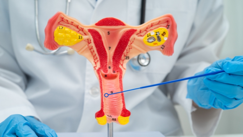 uterine fibroids embolization